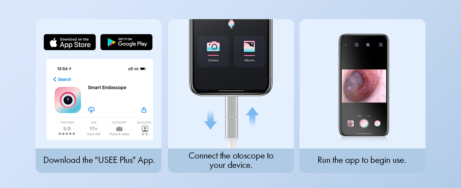 Anykit Digital Otoscope for iPhone, iPad & Android Device