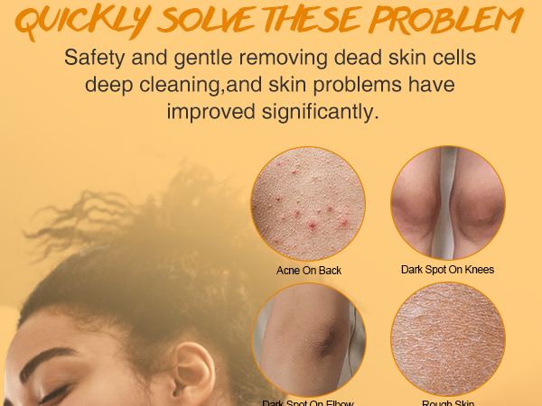 turmeric body scrub for dark spots