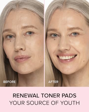 renewal toner pads
