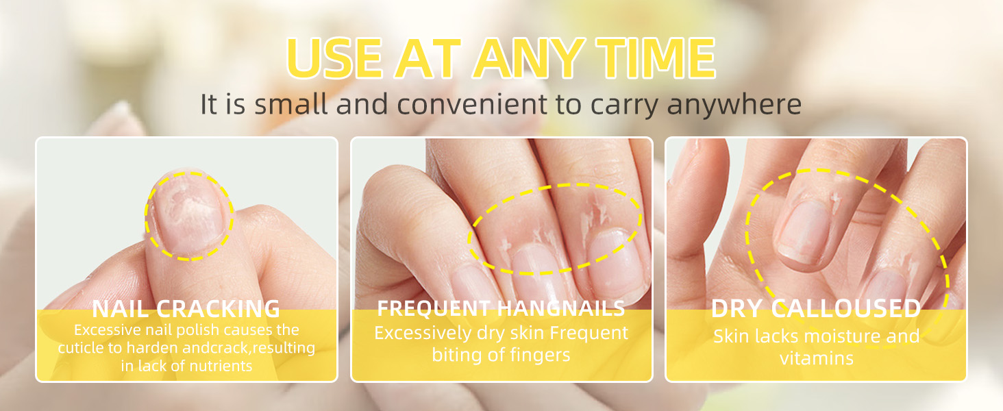 Nail Treatment