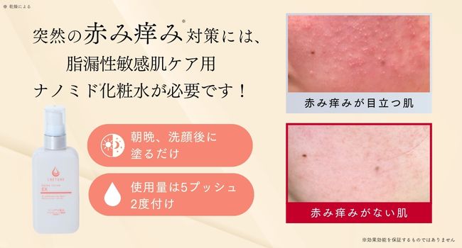 Amazon | 更年期の赤み痒みに クレチュール ジュレローションEX