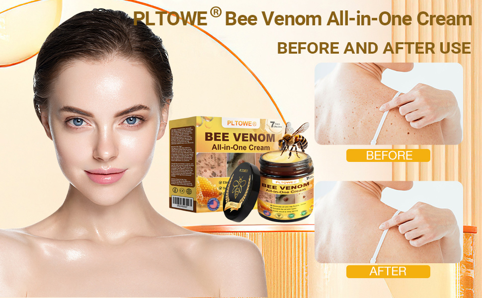 Amazon.com: Bee Venom All-in-One Cream, Bee Venom Skin Treatment Cream - Does Bee Venom Work For Skin Tags
