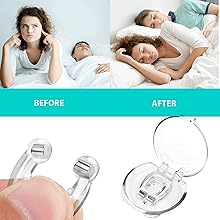 noring Relief Nasal Strips Your Nose Instantly Nose Strips for Snoring Anti Snoring Device