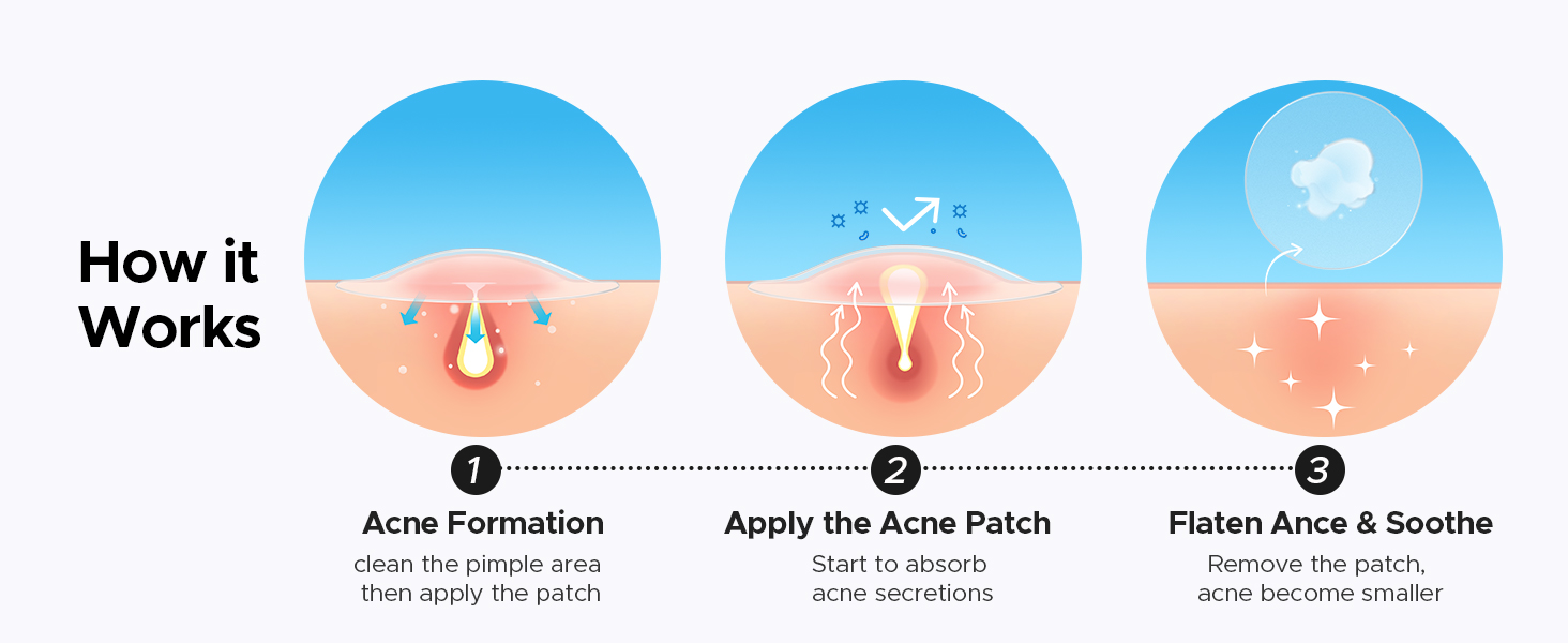 pimple patches