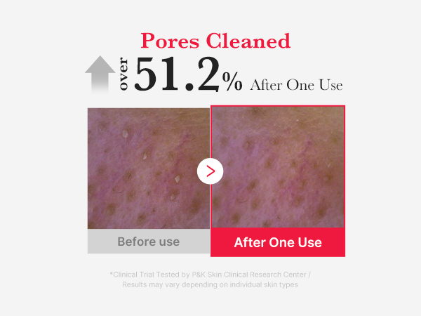 Amazon.com: medicube Red Foam Cleanser - Deeply cleanses