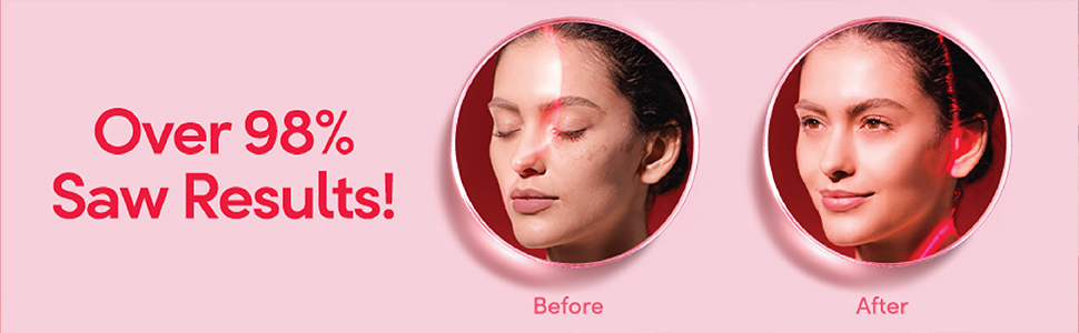 POND’S Age Miracle Wrinkle Corrector Night Cream, 50 g