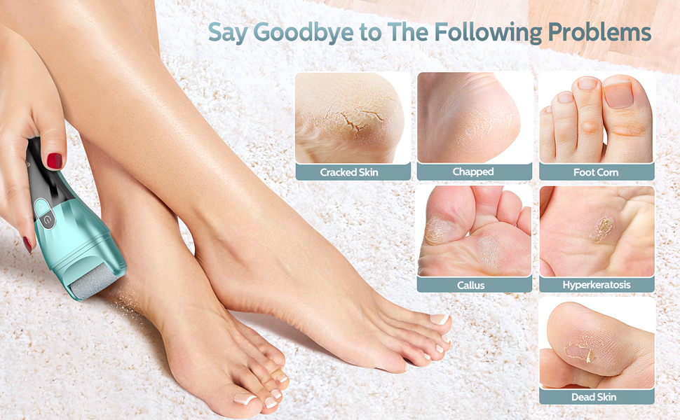 Say Goodbye to The Following Problems