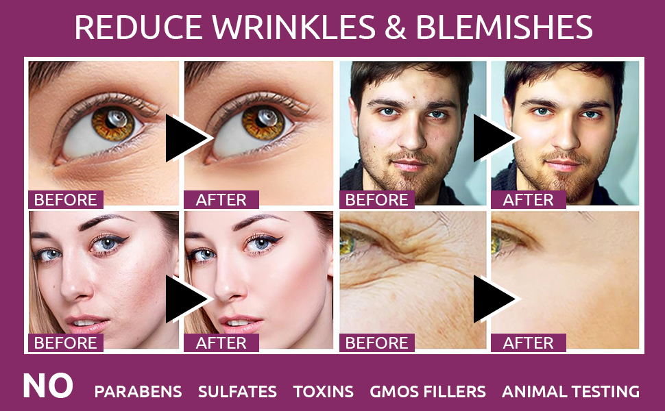 OG BEAUTY AYURVEDA Brightening Kumkumadi Oil Face Gel 