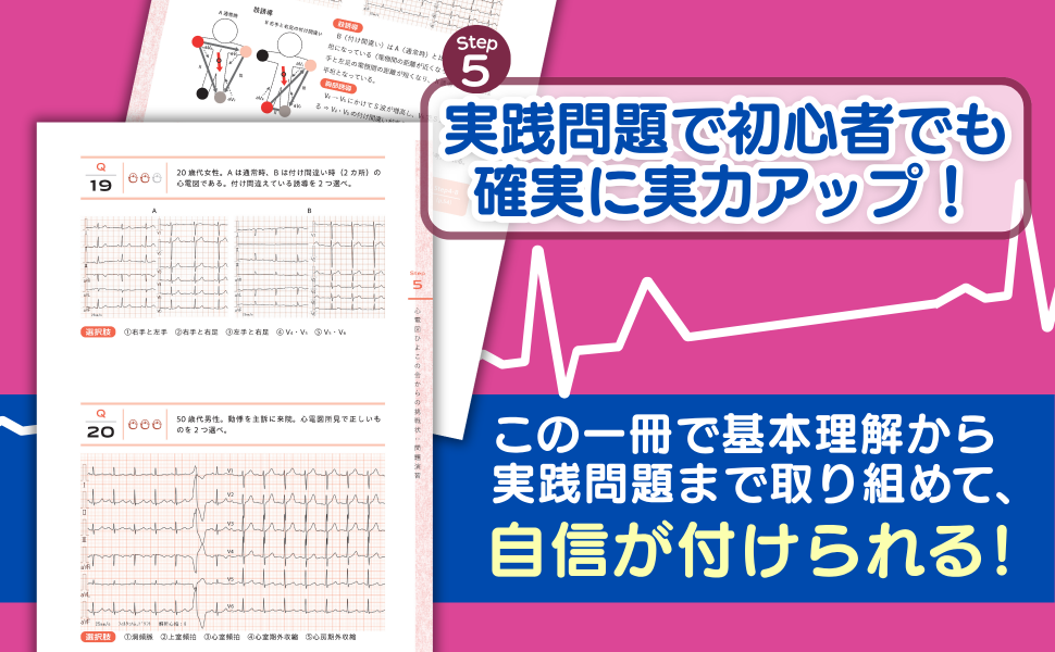 ペ-スメ-カ-心電図読み方・考え方 第２版/文光堂/横山正義（ペーパーバック） ペースメーカー心電図読み方・考え方 | 横山 正義 |本 | 通販
