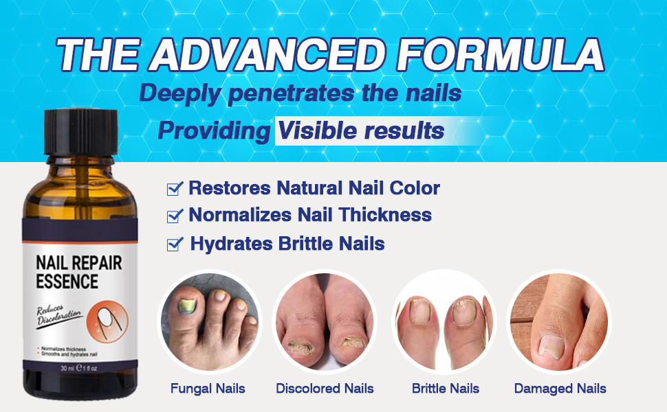 Toenail Fungus Treatment