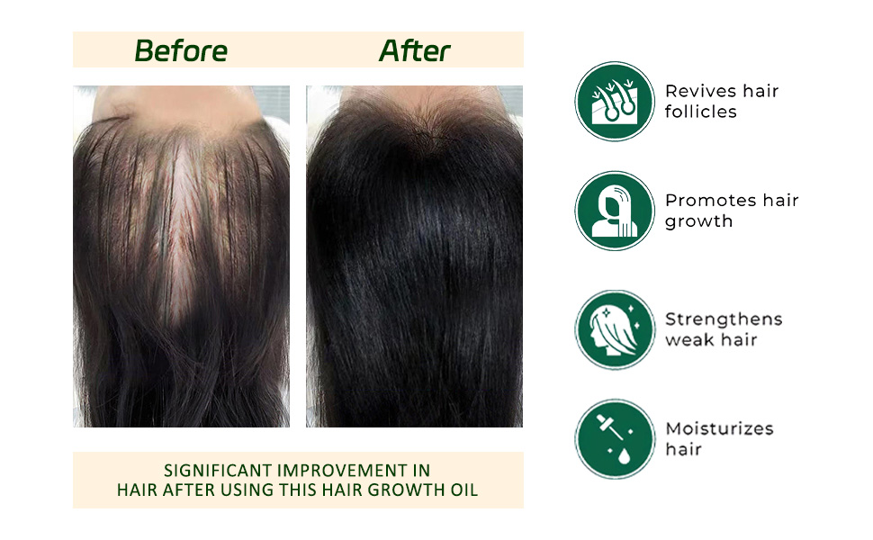 Batana Oil Promotes Hair Growth