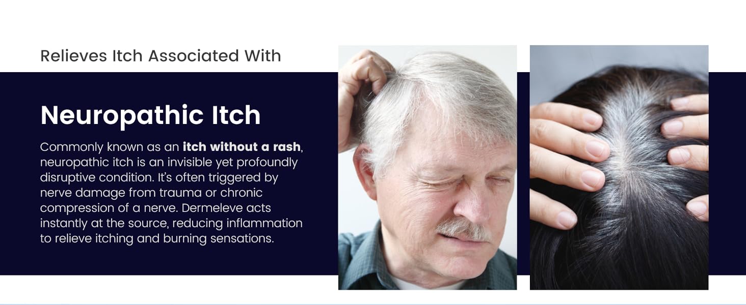 Dermeleve Anti-Itch Serum