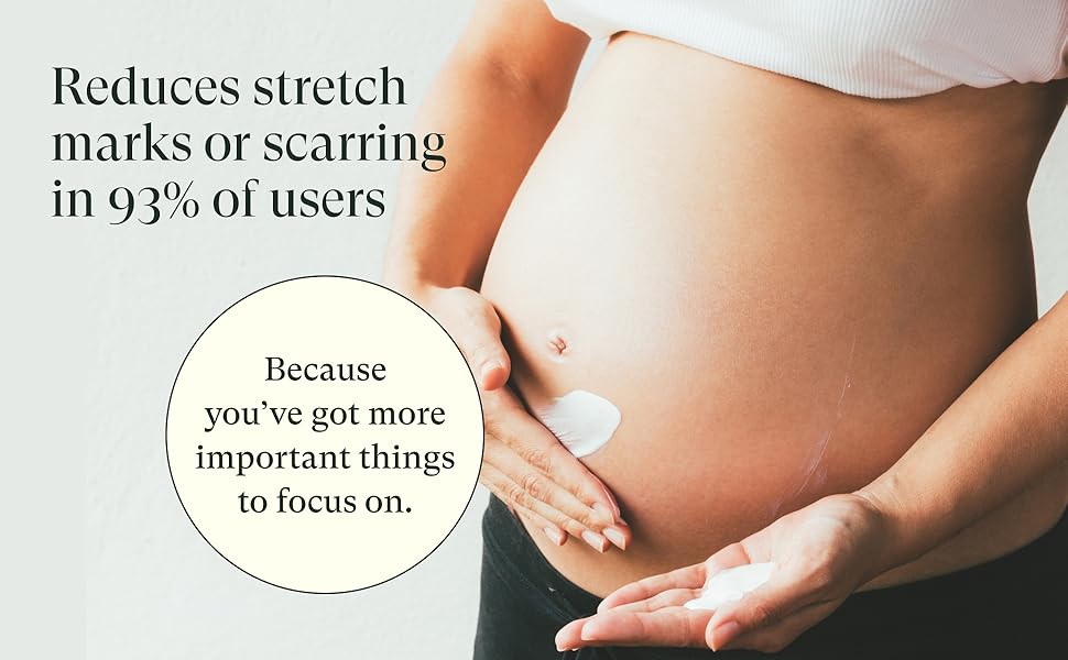 stretch mark cream 