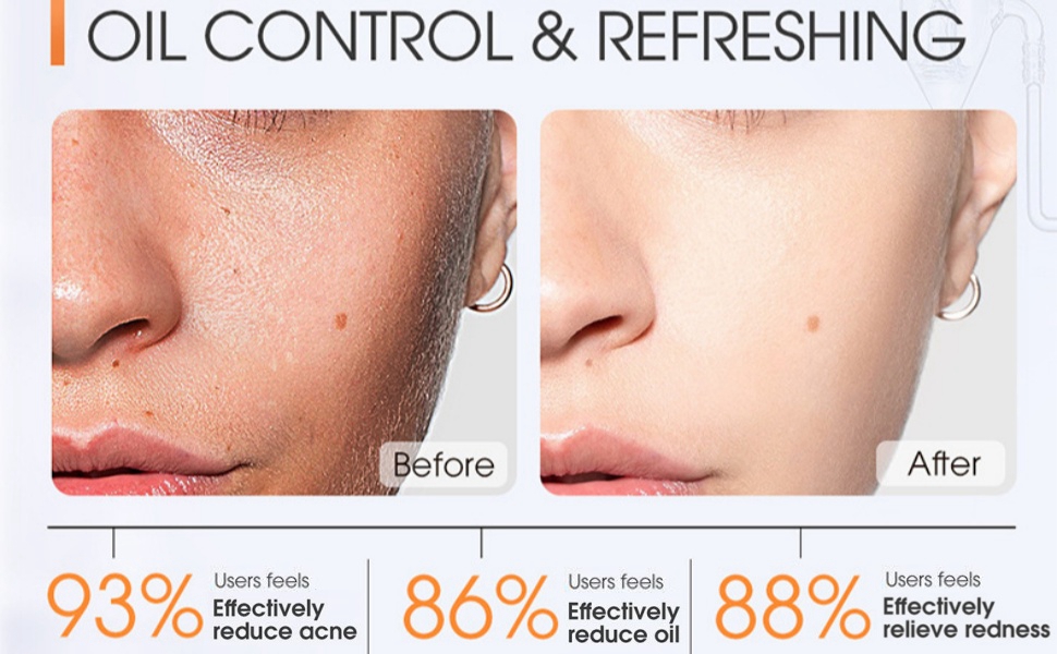 dead skin remover face cleanser dry skin cleansing oil for face facial wash women skincare cleanser