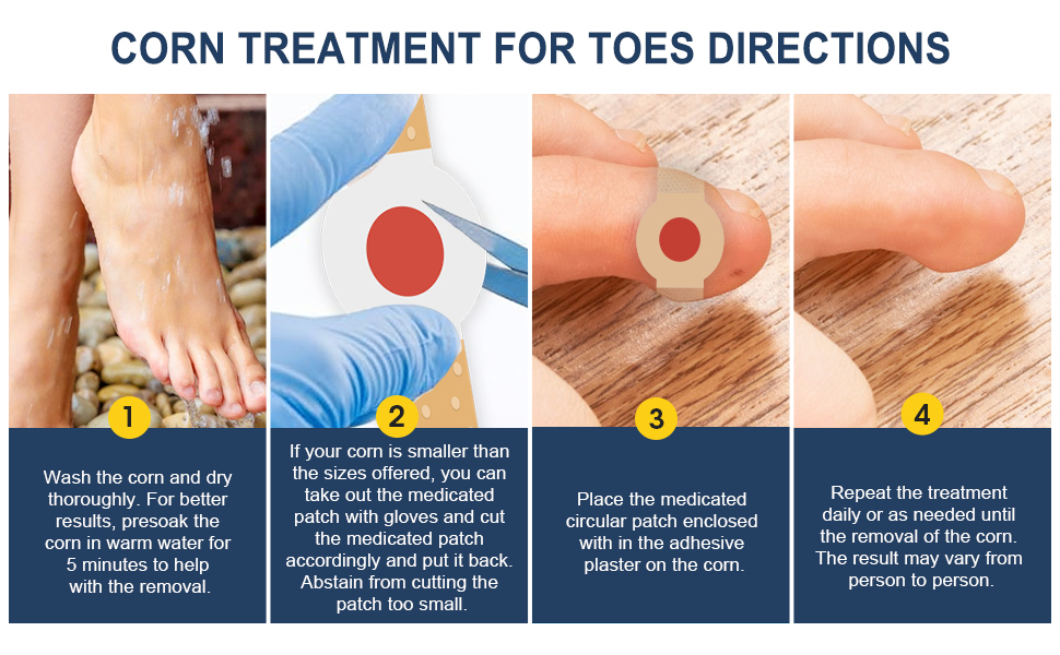 Corn Removers For Feet & Toes, Foot Callus Remover, Corn Removers For