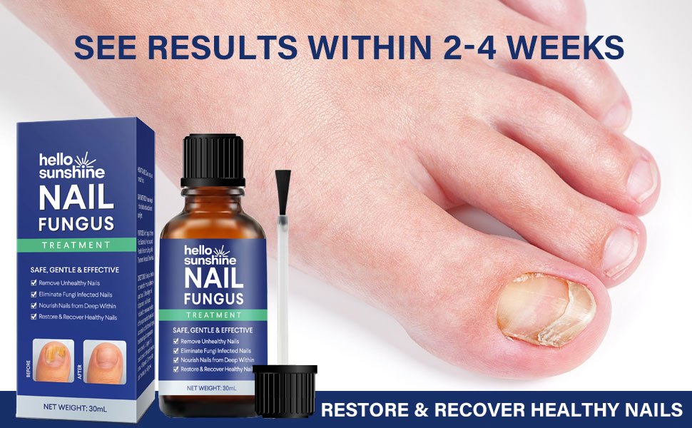 Nail Fungus Treatment for Toenail, Toenail Fungus Treatment, Toe Nail Fungus Treatment Extra