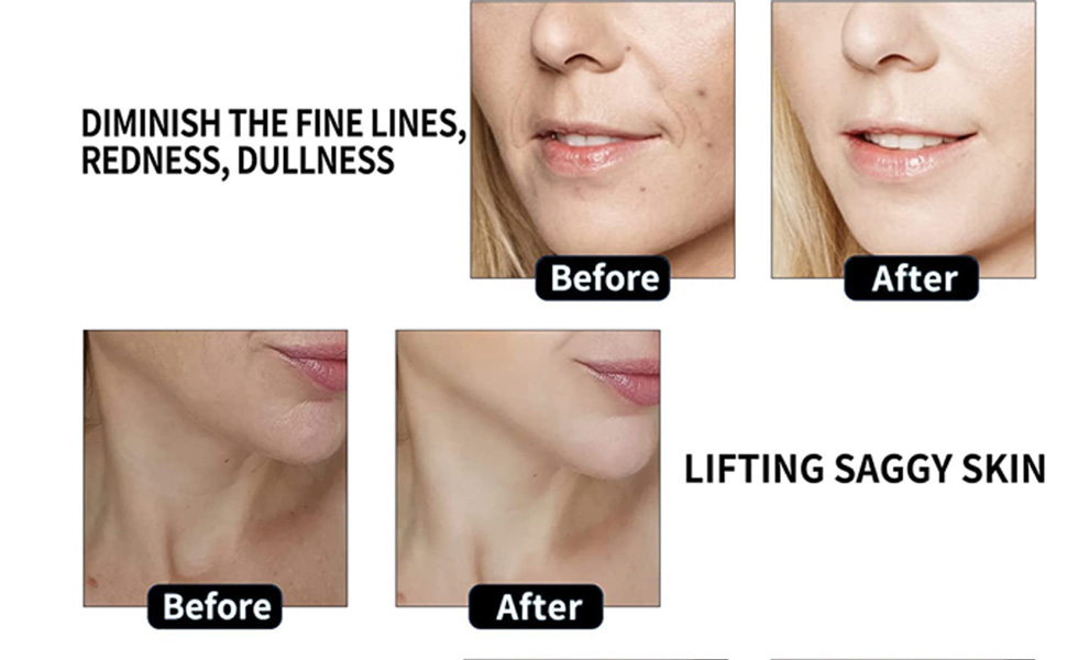 face light therapy mask