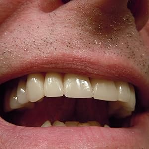 MEDSPO TEETH