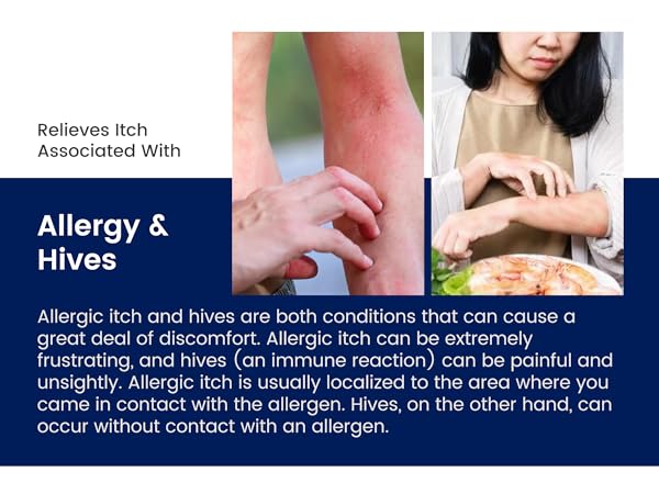 Dermeleve Anti-Itch Cream