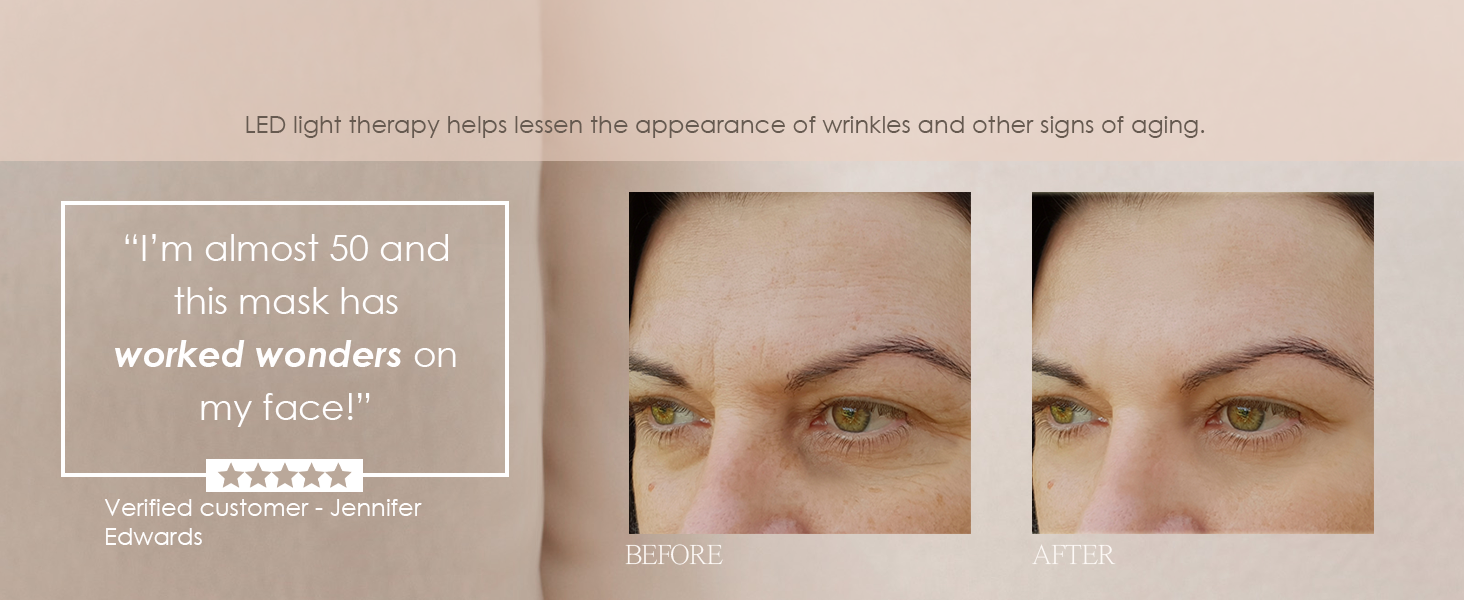 LED light therapy anti-acne anti-aging reduce wrinkles clear skin collagen boost tighter firmer skin