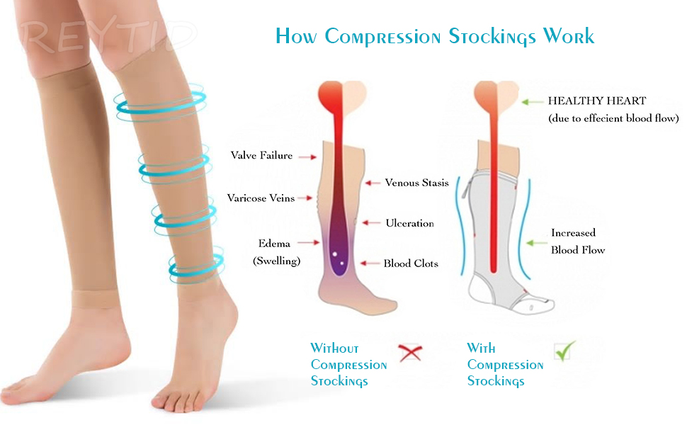  Toeless Compression Stockings for Women Men 20-30 mmhg Knee High Open Toe Compression Socks
