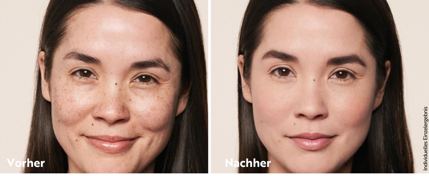 Gegenüberstellung des Gesichts einer Frau mit Darstellung der Vor- und Nachwirkungen einer Hautpflege- oder Schönheitsbehandlung. Das linke Bild zeigt eine besser sichtbare Hautstruktur, das rechte Bild zeigt ein glatteres Hautbild