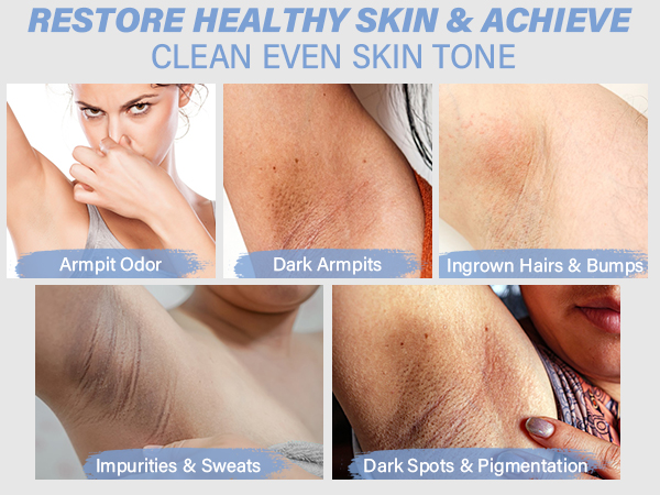 armpit detox scrub reduce armpit dark spots, ingrown hairs, improves dull and rough skin