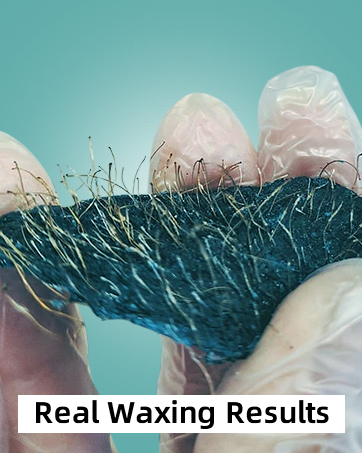 EFFECTIVE HAIR REMOVAL RESULT