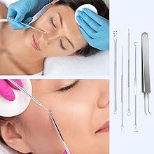 Acne clip extractor application