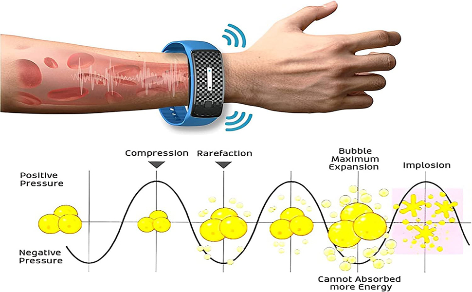  Lymph Detox Magnetic Bracelet, Lymph Drainage Magnetic Bracelet