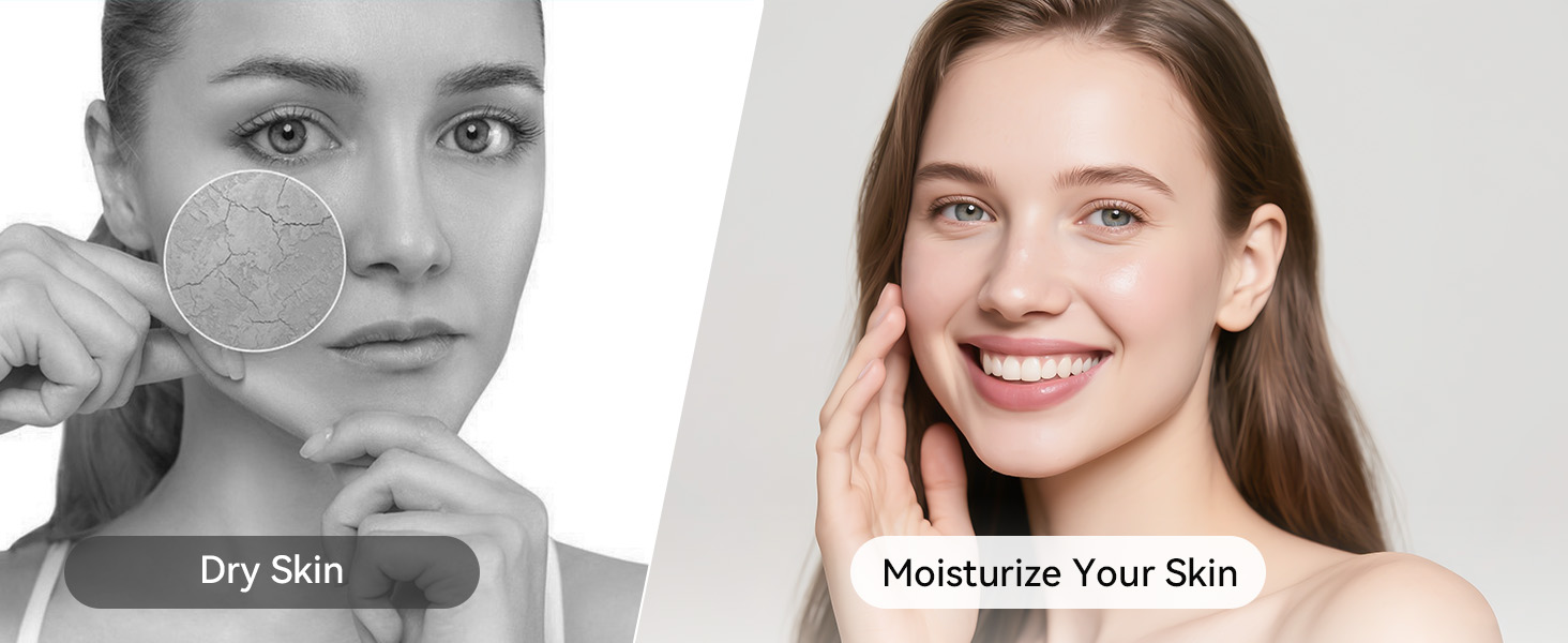 Moisturize Your Skin