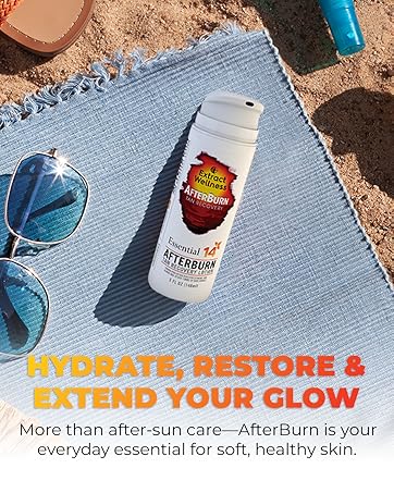 AfterBurn Recovery Lotion
