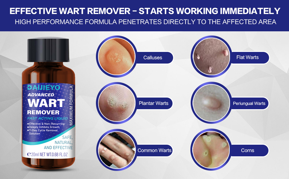 wart remover