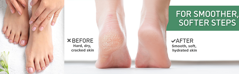 Feet Peeling Mask for Removes Dry Dead Skin, Cracked Heels &Calluses