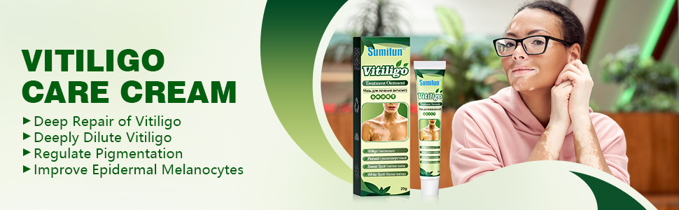 vitiligo cream