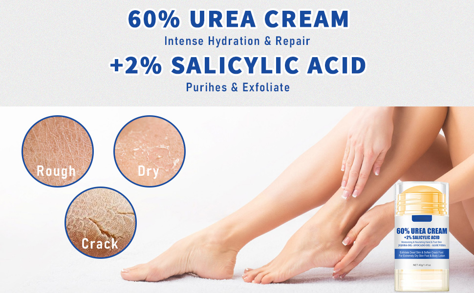 urea cream is ideal for treating extremely dry, cracked, or thickened skin on the hands and feet.
