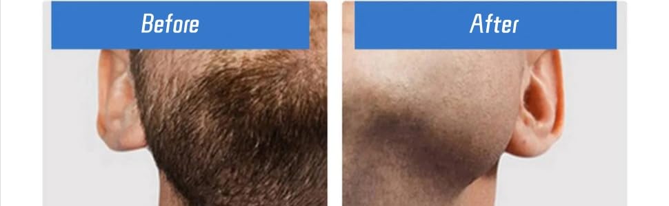 Skin-friendly & High Efficiency