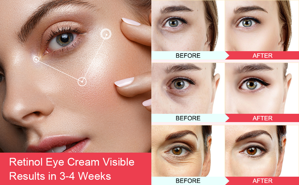 Anti Aging Eye Cream with Hyaluronic Acid and Collagen Under Eye Cream Retinol Eye Stick