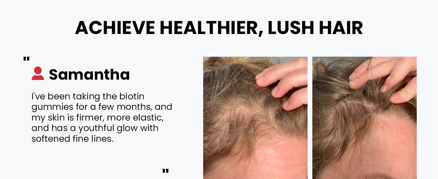 Biotin Gummies for Hair Skin & Nails