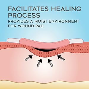 calcium silver alginate wound dressing silver nitrate sticks calcium alginate wound dressing 