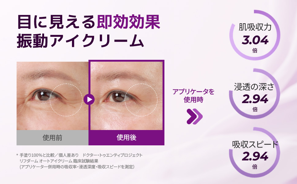 Amazon.co.jp: [Dr.twentyproject] リプダム オートアイクリーム