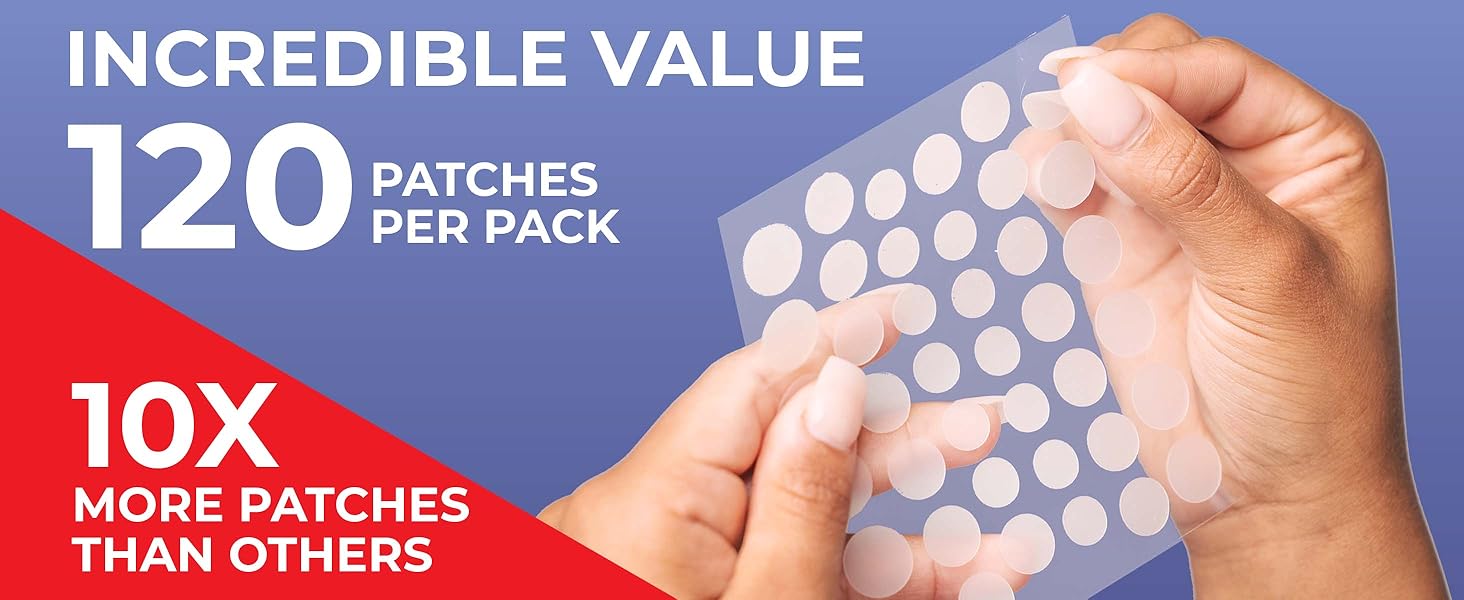 pimple patch, pimple patches, acne patches, pimple patches for face, acne treatment, acne