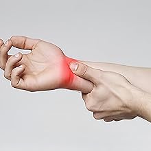 Carpal Tunnel Syndrome