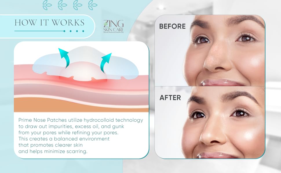 how it works hydrocolloid gunk pores out before and after