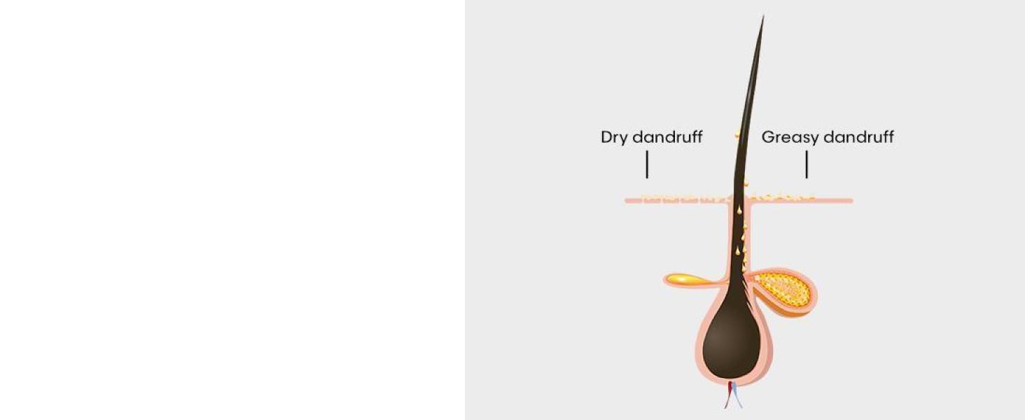 Hair follicle graphic