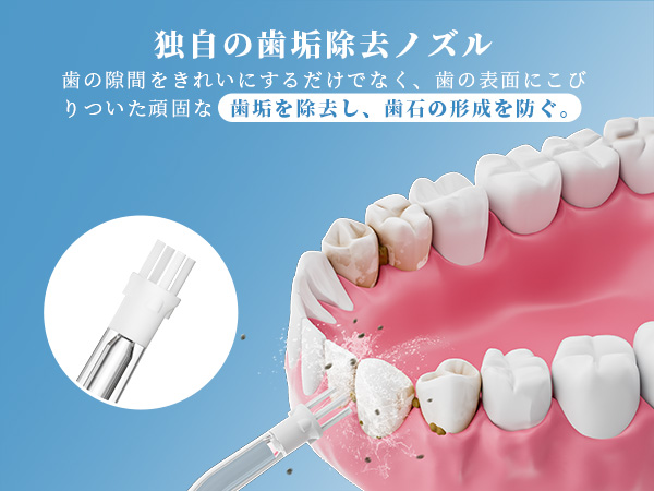 ●99.9%以上歯垢除去力　口腔洗浄器　クリーニング Amazon.co.jp: 口腔洗浄器 ジェットウォッシャー 歯垢除去率99.9