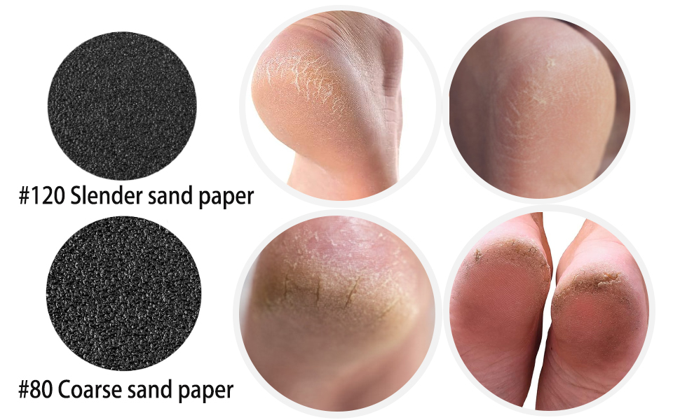 Replaceable Sandpaper Refill Discs for Electric Callus Remover Dead Cracked Skin Remover