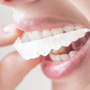 di Denti Finti Bretelle Bianche