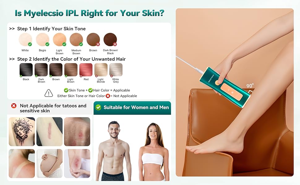 IPL laser hair removal