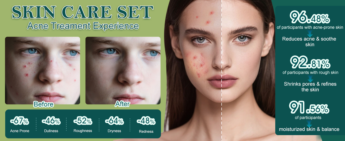 Tea Tree Essential Oil Acne Treatment Kit for Teens 10-12